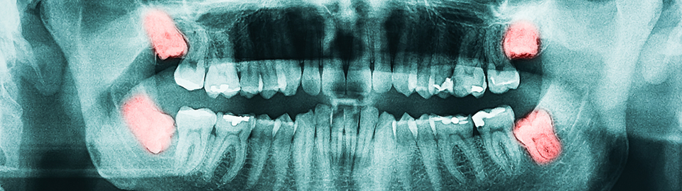 ON MAUM DENTAL CLINIC