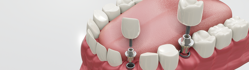 ON MAUM DENTAL CLINIC